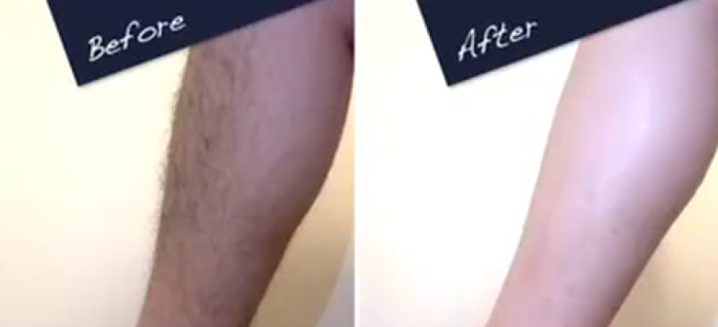 【除毛クリーム案件】　すね毛の濃い男性を探しています
