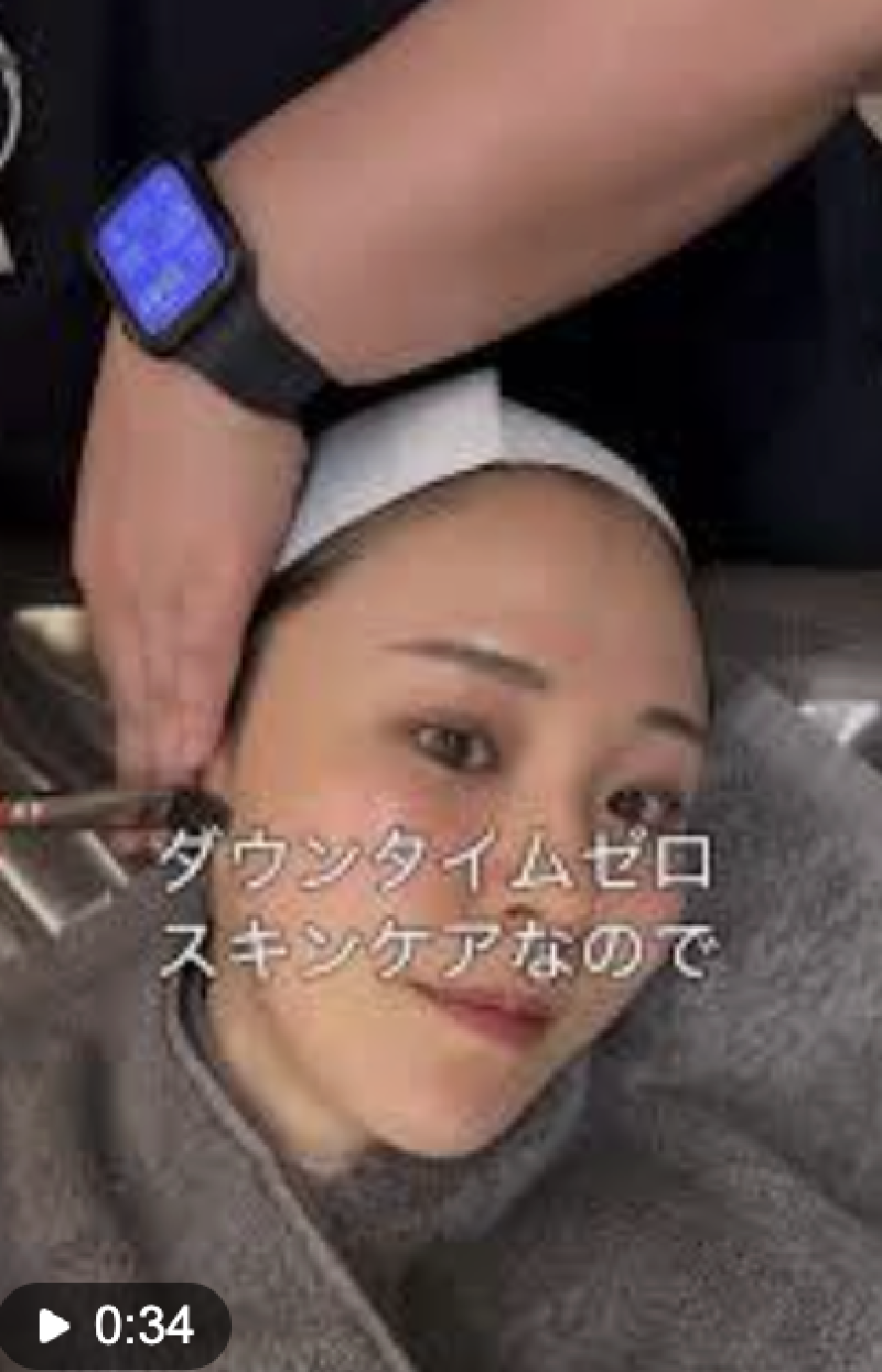 大手インフルエンサー起用のクリニックの広告案件の出演！ 男女3名ずつ募集！10月末締切！ サブ画像